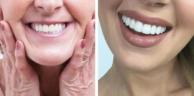 Tu sonrisa perfecta en segundos — sin dolor, sin dentista, sin gastar una fortuna